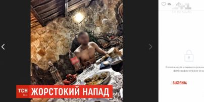 18-летняя девушка обвиняет бывшего парня в жестоком избиении