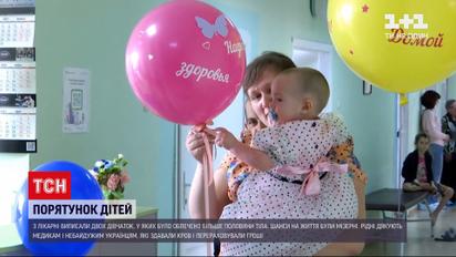Новини України: у Дніпрі лікарям вдалося врятувати двох дівчаток, які зазнали 60 % опіків тіла