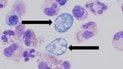 Naegleria fowleri. Фото: Dr. James Roberts