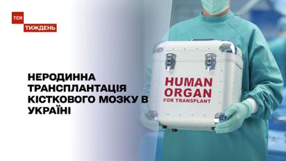 Новини тижня: у чому складність неродинної трансплантації кісткового мозку в Україні