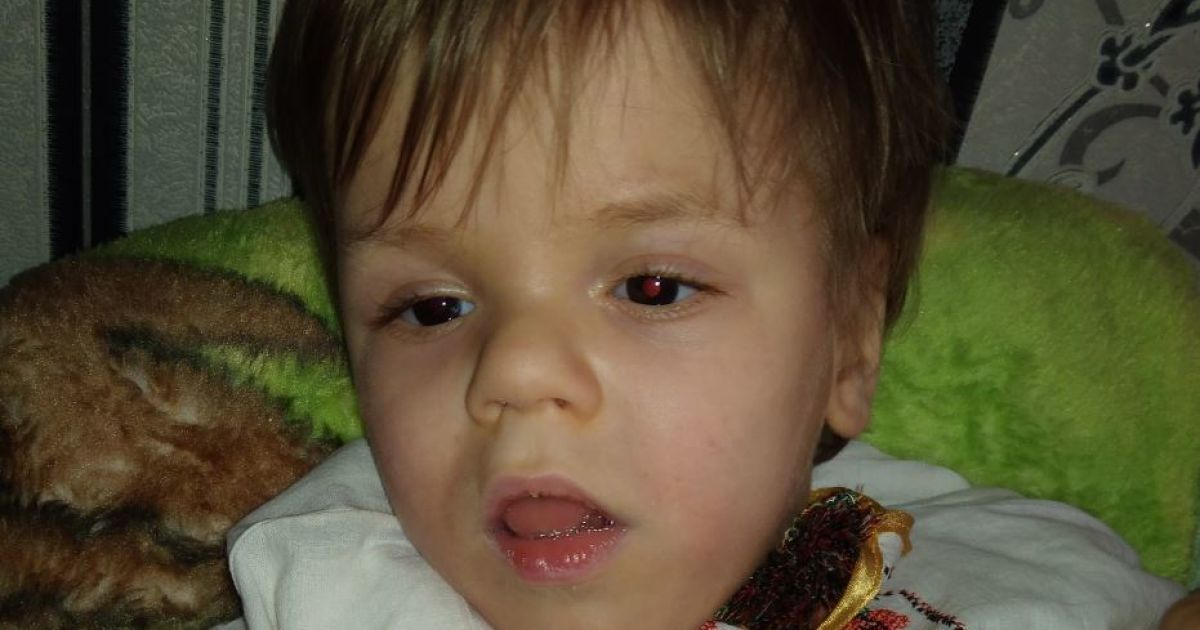 Передчасне народження і 900-грамова вага: Матвійку потрібна посилена реабілітація