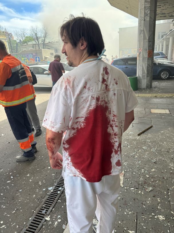 Олег Голубченко после обстрела детской больницы "Охматдет". Фото Олега Голубченко