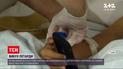Новости Украины: 6-летнему мальчику из Львовской области оторвало пальцы при взрыве петарды