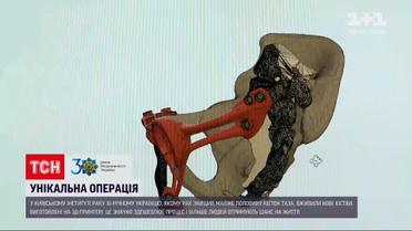 Новости Украины: в Киеве 16-летнему парню сделали уникальную операцию с вживлением костей