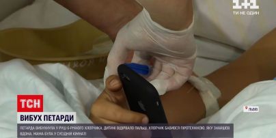 Новини України: 6-річному хлопчику із Львівської області відірвало пальці під час вибуху петарди