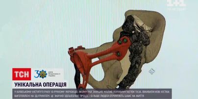 Новини України: у Києві 16-річному хлопцю зробили унікальну операцію зі вживленням кісток