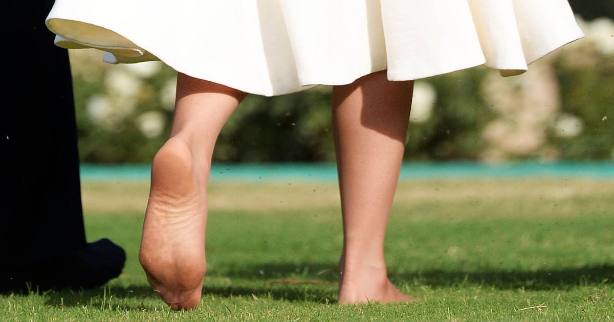 Герцогиня в опасности: ортопедов шокировали фото обнаженной ступни Кейт