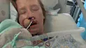 Собака вчепився в обличчя 20-річної дівчини — наслідки нападу