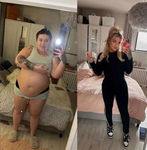 Каоймхе Вайт до і після схуднення / © dailystar.co.uk