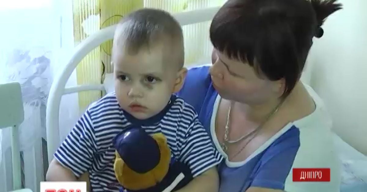 Дворічного хлопчика з Авдіївки, що випав із вікна, доправили до реанімації Дніпра
