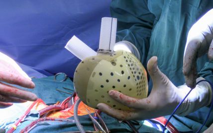 Уникальная операция: немецкие врачи впервые пересадили искусственное сердце