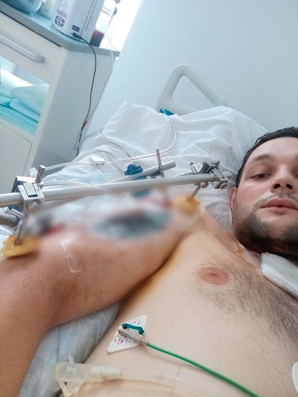 Виталий Лановский после ранения