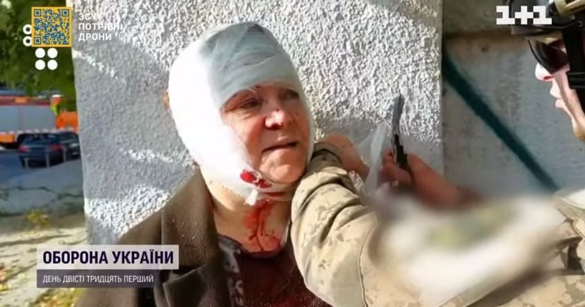 Пока он останавливал ей кровотечение, она обещала ему блины: раненая киевлянка встретилась со своим спасителем
