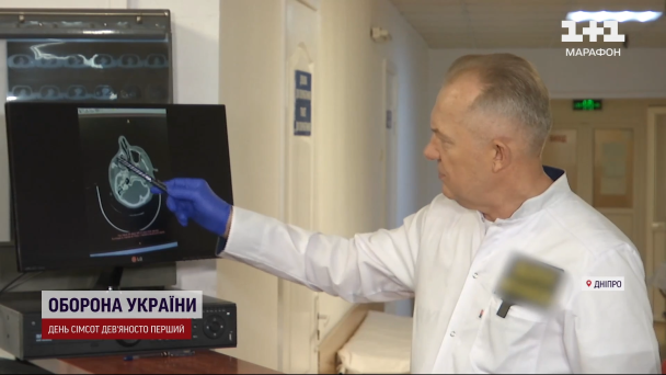 Медик про стан військового