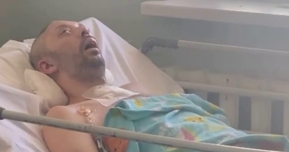 Постраждалий після зустрічі з ТЦК