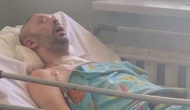 "Так упав, що опинився в комі": Лубінець шокував подробицями інциденту з ТЦК у Дніпрі