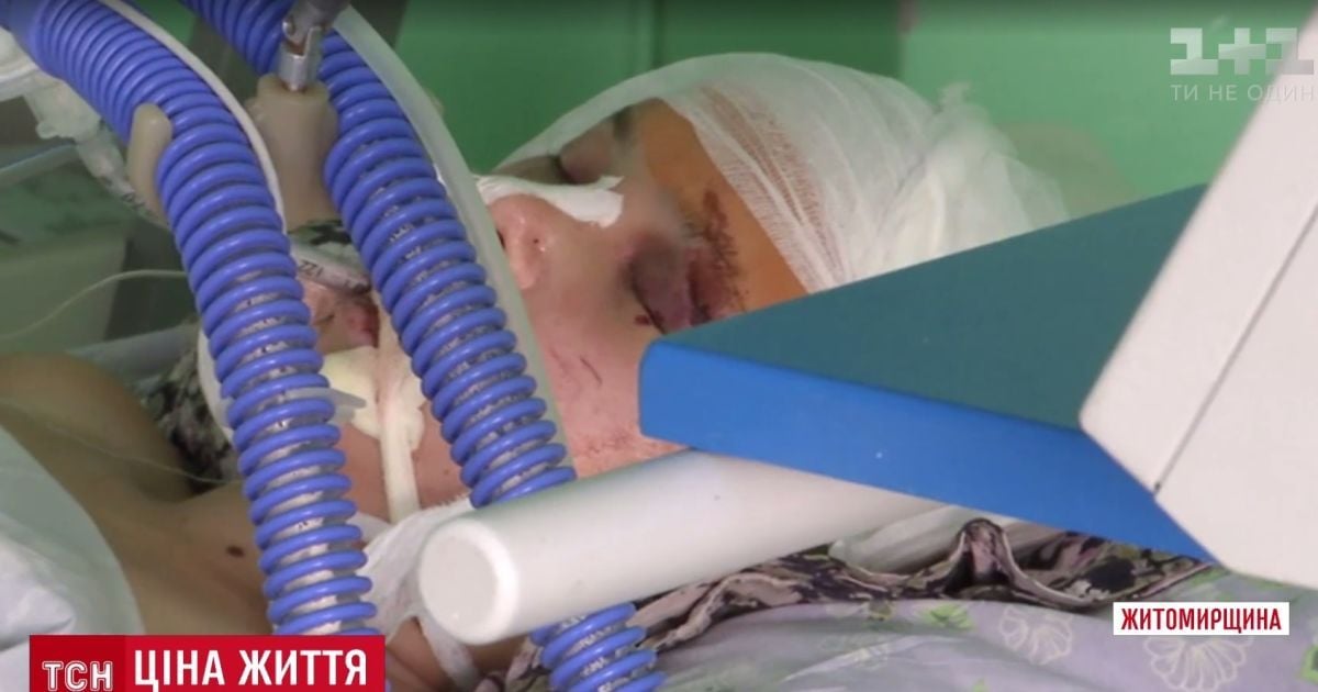 Сельские подростки на Житомирщине забили почти до смерти 17-летнюю девушку за 500 гривен