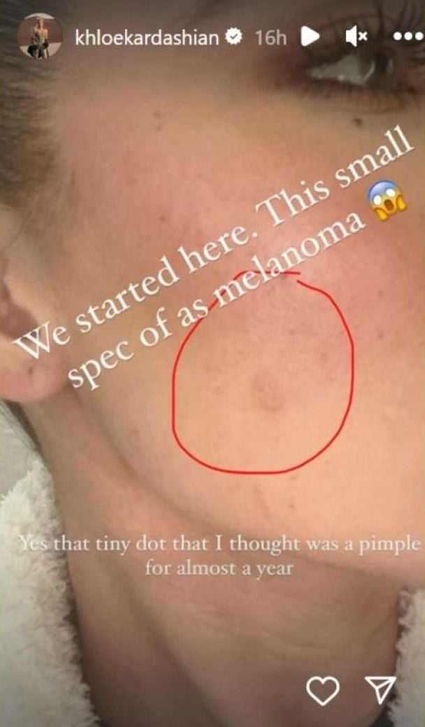 Хлоя Кардашьян / © instagram.com/khloekardashian