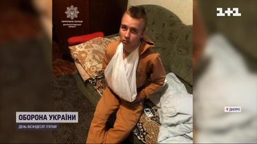 Поранений підліток втік з лікарні й ішов пішки кілька годин, щоб побачити рідних
