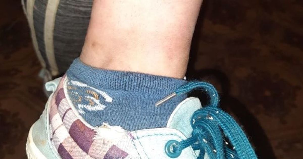 У Луганській області мати виховувала 14-річну доньку, вдягаючи на ноги ланцюг