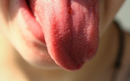 Наліт на язику: що він може розповісти про ваше здоров'я