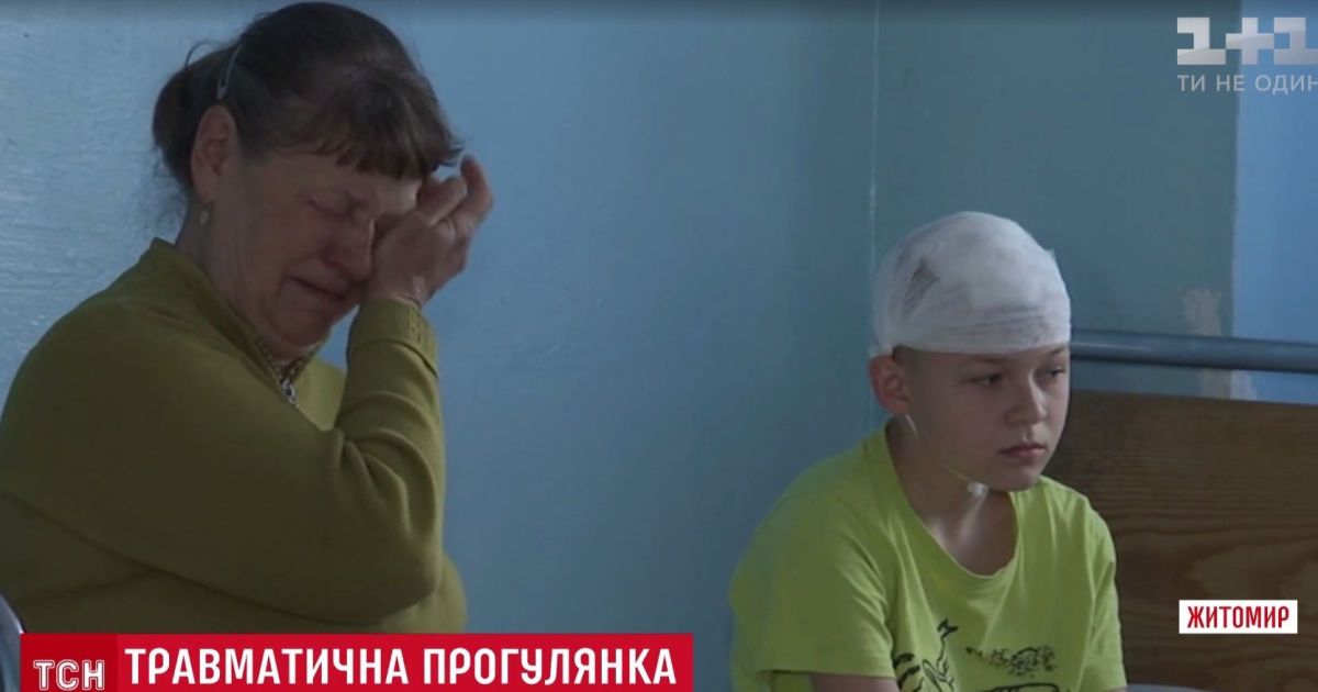 У Житомирі тролейбусна штанга "відправила" школяра до лікарні
