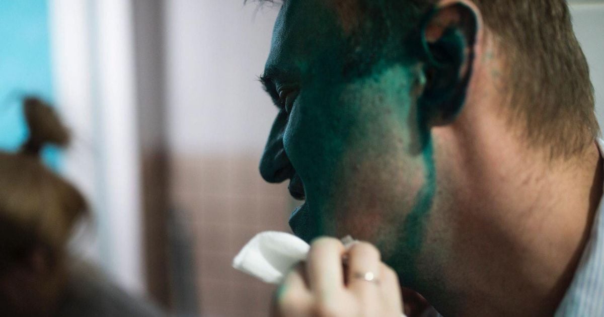 Навального облили зеленкою _3 / © Сайт Алексеея Навального