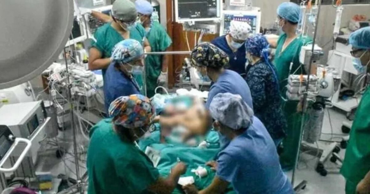 У Перу роз'єднали сіамських близнюків