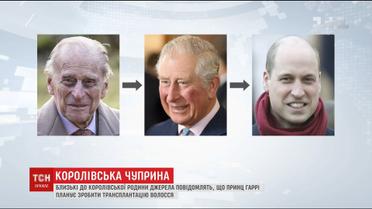 Не втрачене волосся: скільки в Україні коштує повернути чоловічу шевелюру