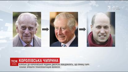 Не утраченные волосы: сколько в Украине стоит вернуть мужскую шевелюру