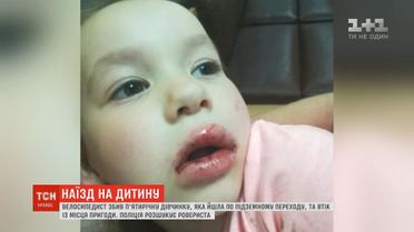 Численні забої та вибиті зуби: у Києві велосипедист збив дівчинку та втік