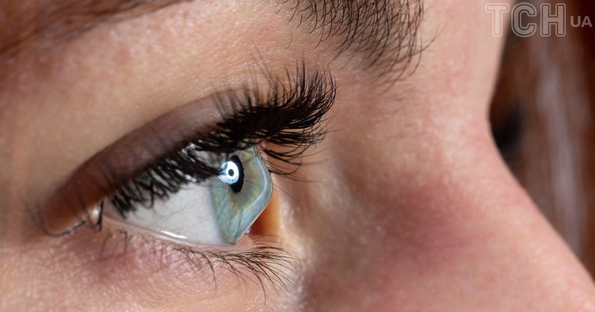 Стоншення рогівки ока: лікар-офтальмолог розповів, як не втратити зір