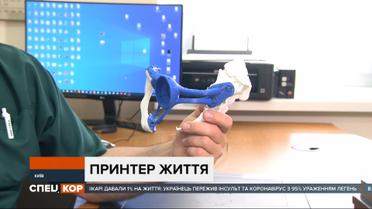 Технології вже сьогодні рятують життя: в Київському інституті раку зробили унікальну операцію