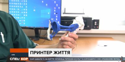 Технології вже сьогодні рятують життя: в Київському інституті раку зробили унікальну операцію