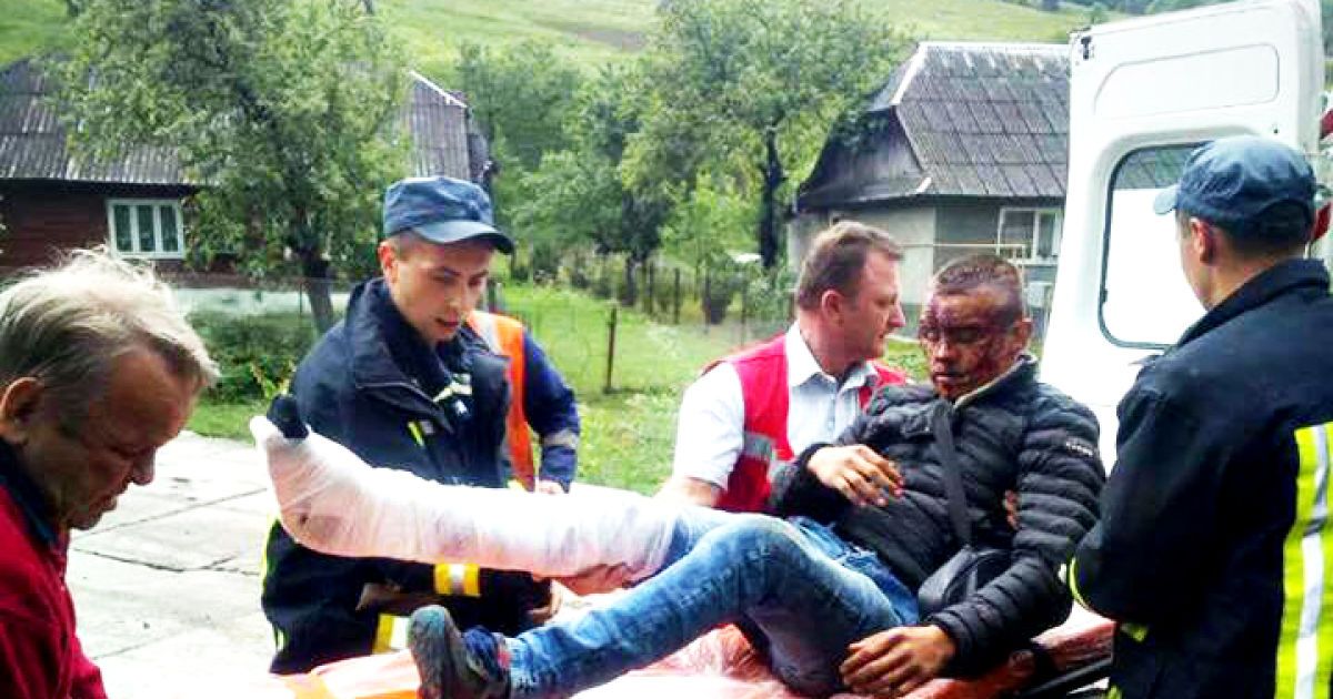Окровавленное лицо и нога в гипсе. На Закарпатье парень выпал из поезда