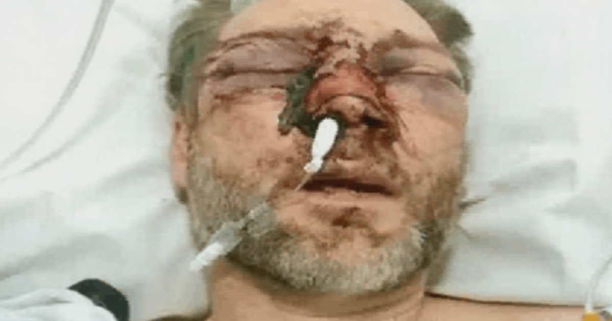 Лицо как растоптанные хлопья. В Англии подросток избил преподавателя, что тот едва не потерял зрение