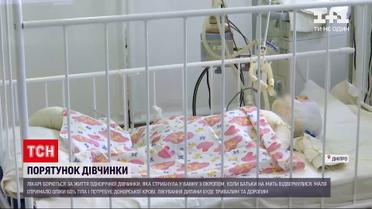 Новости Украины: в Днепре продолжаются поиски доноров крови для девочки с тяжелыми ожогами кожи