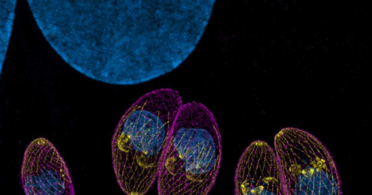 Toxoplasma gondii. Фото: Морн Арин, Ксена Лонгрин/CC BY 4.0/Wikipedia