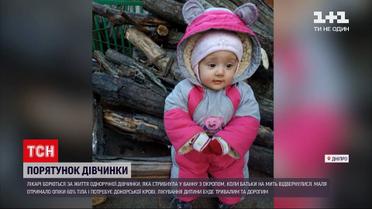Новини України: у Дніпрі терміново шукають донорів крові для однорічної обпеченої дівчинки