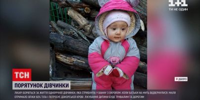 Новини України: у Дніпрі терміново шукають донорів крові для однорічної обпеченої дівчинки