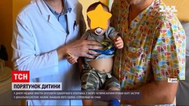 Новости Украины: 1-летний малыш, едва не погибший из-за металлического болта, полностью здоров