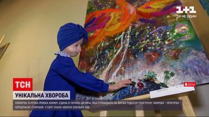 Новини України: у Вінницькій області 10-річна дівчинка померла від старості