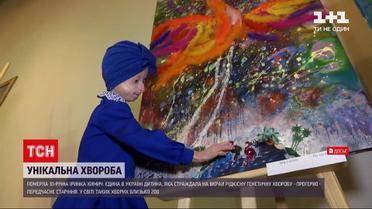 Новости Украины: в Винницкой области 10-летняя девочка умерла от старости