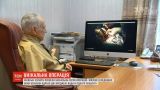 Киевские хирурги провели уникальную серию операций девочке с врожденными пороками