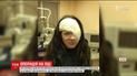 Певица Руслана выступила в Бухаресте с открытой раной на глазу