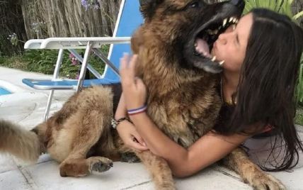 В Аргентині пес вкусив дівчину просто за обличчя на спільній фотосесії