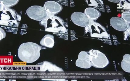 В Україні вперше видалили гігантську пухлину у немовляти, яка була вдвічі більшою за його голову