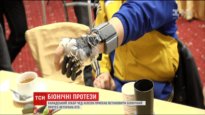 Лікар з Канади приїхав в Україну, щоб встановити протез воїну АТО