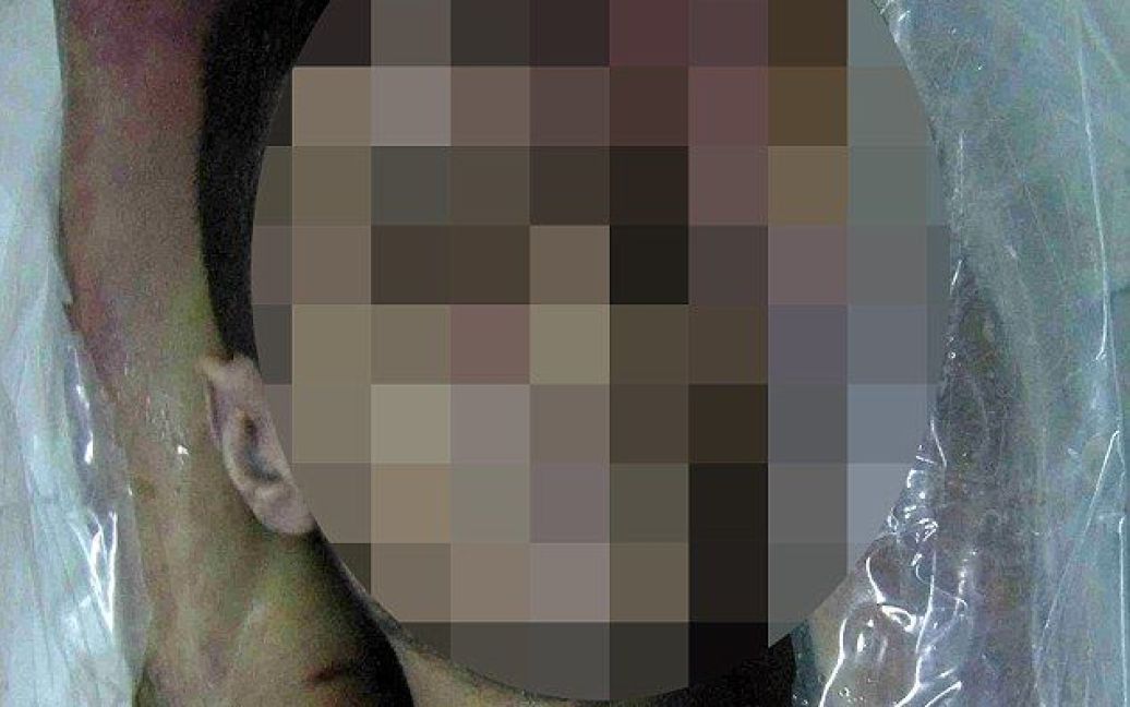 Дядько хлопця знайшов фото його понівеченого тіла серед знімків військового фотографа "Цезара". / © Daily Mail