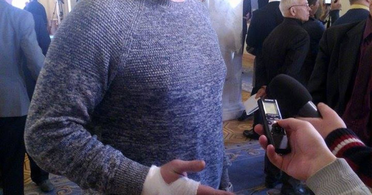 У нардепа зламана рука